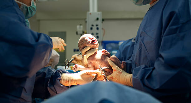 Cesarean Delivery